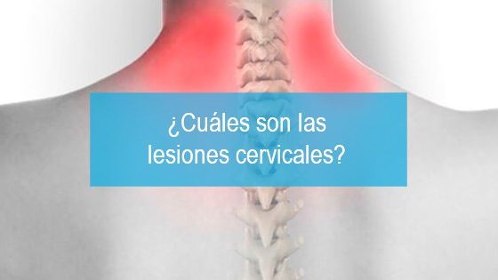 ¿Cuáles son las lesiones cervicales?